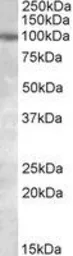 Anti-Polycystin 2 antibody, Internal used in Western Blot (WB). GTX88317