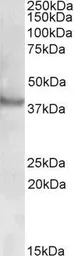 Anti-Rapsyn antibody, N-term used in Western Blot (WB). GTX88362