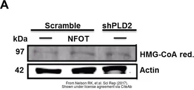 Anti-HMGCR antibody, Internal used in Western Blot (WB). GTX88456