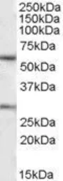 Anti-KCNQ1 antibody, C-term used in Western Blot (WB). GTX88458