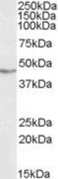 Anti-TDP43 antibody, Internal used in Western Blot (WB). GTX88503