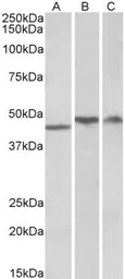 Anti-TDP43 antibody, Internal used in Western Blot (WB). GTX88503