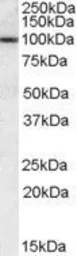 Anti-CLCA1 (aa872-884) antibody, Internal used in Western Blot (WB). GTX88552