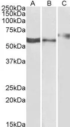 Anti-P2X4 antibody, C-term used in Western Blot (WB). GTX88599