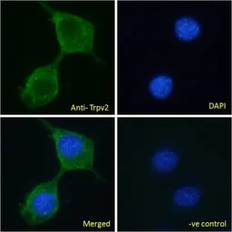 Anti-VRL1 antibody, C-term used in Immunocytochemistry/ Immunofluorescence (ICC/IF). GTX88614