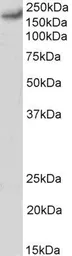 Anti-Cav1.2 antibody, C-term used in Western Blot (WB). GTX88630