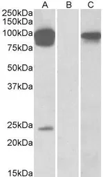 Anti-TRPV3 antibody, Internal used in Western Blot (WB). GTX88648