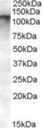 Anti-ABCC11 antibody, Internal used in Western Blot (WB). GTX88673