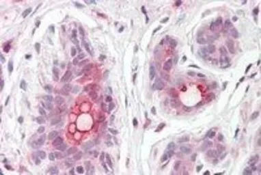 Anti-ABCC11 antibody, Internal used in IHC (Paraffin sections) (IHC-P). GTX88673
