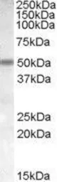 Anti-AChR beta 3 antibody, Internal used in Western Blot (WB). GTX88687