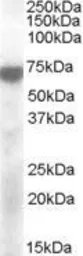 Anti-KCNQ4 antibody, Internal used in Western Blot (WB). GTX88722