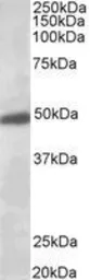 Anti-GIRK2 antibody, C-term used in Western Blot (WB). GTX88962