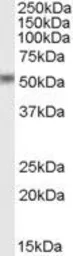 Anti-STEAP4 antibody, C-term used in Western Blot (WB). GTX88989
