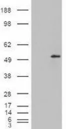 Anti-STEAP4 antibody, C-term used in Western Blot (WB). GTX88989