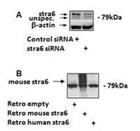 Anti-STRA6 (mouse, rat) antibody, C-term used in Western Blot (WB). GTX89070