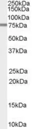 Anti-PDE4D3 antibody, N-term used in Western Blot (WB). GTX89159