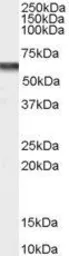 Anti-Cav beta 4 antibody, Internal used in Western Blot (WB). GTX89203