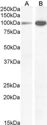 Anti-NMDAR1 antibody, Internal used in Western Blot (WB). GTX89302