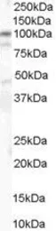 Anti-alpha 1 Catenin antibody, Internal used in Western Blot (WB). GTX89347