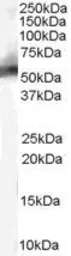 Anti-MDM2 antibody, Internal used in Western Blot (WB). GTX89355