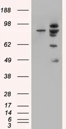 Anti-MDM2 antibody, Internal used in Western Blot (WB). GTX89355