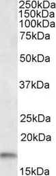 Anti-Iba1 (isoform 3) antibody, Internal used in Western Blot (WB). GTX89367