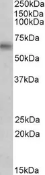 Anti-Monoamine Oxidase B antibody, Internal used in Western Blot (WB). GTX89368