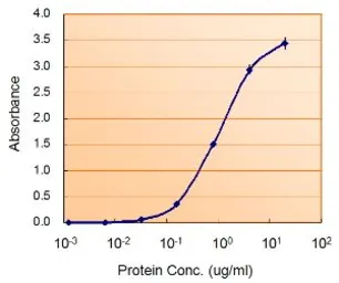 Anti-Monoamine Oxidase B antibody, Internal used in ELISA (ELISA). GTX89368