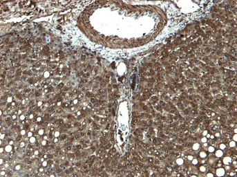 Anti-CYP3A4 antibody, Internal used in Immunocytochemistry/ Immunofluorescence (ICC/IF). GTX89375