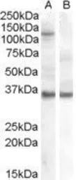 Anti-AGO1 antibody, Internal used in Western Blot (WB). GTX89393