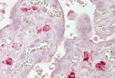 Anti-AGO1 antibody, Internal used in IHC (Paraffin sections) (IHC-P). GTX89393