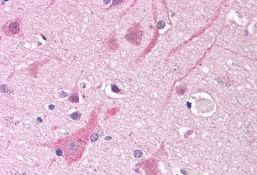 Anti-Nav1.5 antibody, Internal used in IHC (Paraffin sections) (IHC-P). GTX89500