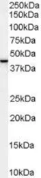 Anti-SPFH2 antibody, C-term used in Western Blot (WB). GTX89522
