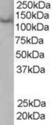 Anti-Rabenosyn 5 antibody, C-term used in Western Blot (WB). GTX89692