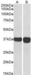 Anti-GAPDH antibody, C-term used in Western Blot (WB). GTX89740