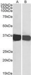 Anti-GAPDH antibody, C-term used in Western Blot (WB). GTX89740