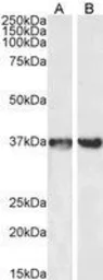 Anti-GAPDH antibody, C-term used in Western Blot (WB). GTX89740