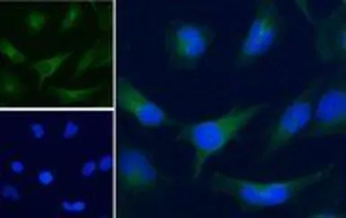 Anti-GAPDH antibody, C-term used in Immunocytochemistry/ Immunofluorescence (ICC/IF). GTX89740