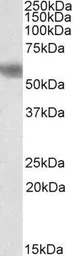 Anti-DUSP8 antibody, N-term used in Western Blot (WB). GTX89940