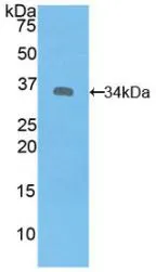WB analysis of GTX00233-pro Human Syk protein (active).