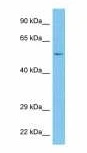 WB analysis of human fetal liver tissue lysate using GTX00670 CMPK2 antibody. <br>Dilution : 1 ?g/ml
