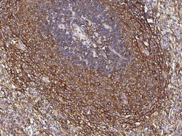 IHC-P analysis of human spleen tissue section using GTX02000 CCR1 antibody [003].<br>Dilution : 1:500
