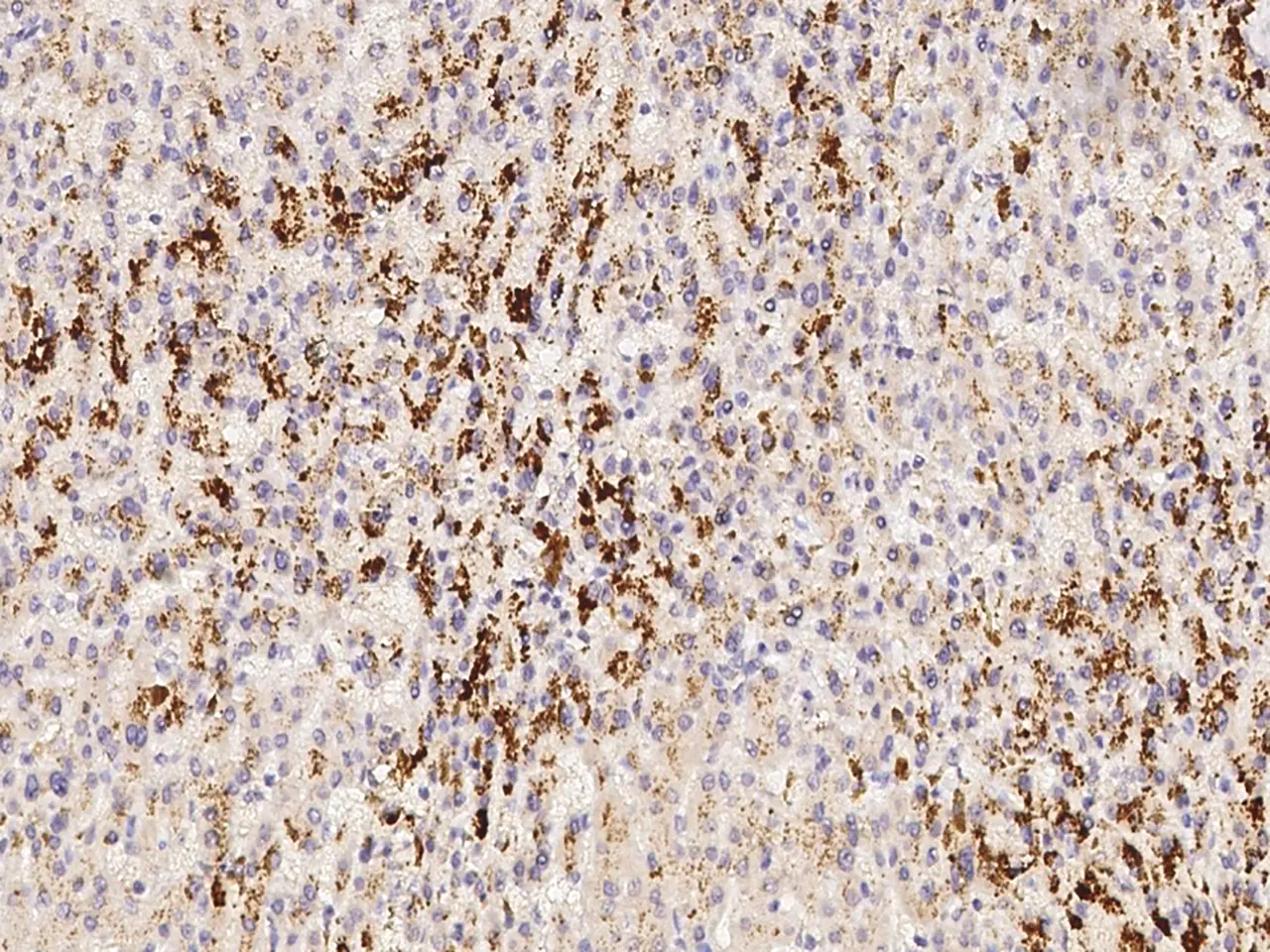 IHC-P analysis of human liver tissue section using GTX02111 VEGF antibody [13].<br>Dilution : 1:30