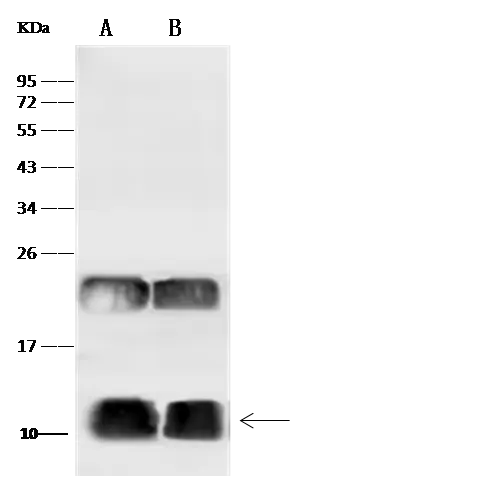 WB analysis of various samples using GTX02501 UBA52 antibody.<br>Lane A : 293T whole cell lysate<br>Lane B : Raji whole cell lysate<br>Dilution : 1:500<br>Loading : 30 ?g