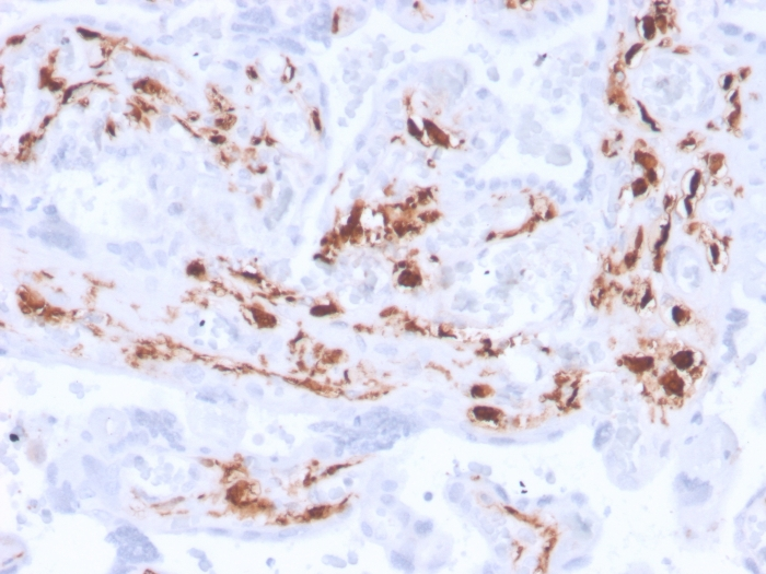 IHC-P analysis of human placenta tissue section using GTX02636 Factor XIIIa antibody [F13A1/3772R].