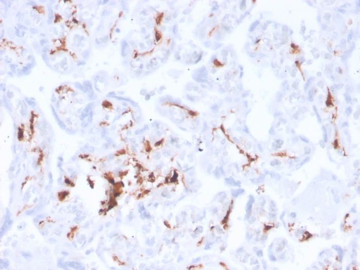 IHC-P analysis of human placenta tissue section using GTX02636 Factor XIIIa antibody [F13A1/3772R].