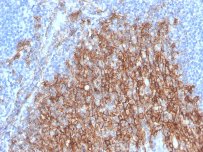IHC-P analysis of human small intestine tissue section using GTX02707 Syndecan-1 / CD138 antibody [SDC1/4378R].
