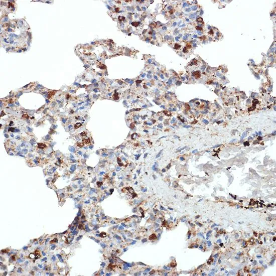 IHC-P analysis of rat lung tissue section using GTX03182 LIMP II antibody [GT1270]. Dilution : 1:100