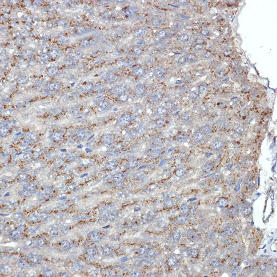 IHC-P analysis of mouse liver tissue section using GTX03182 LIMP II antibody [GT1270]. Dilution : 1:100