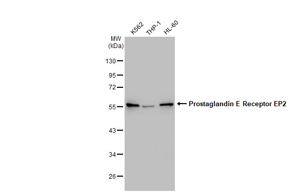 Various whole cell extracts (30 microg) were separated by 10% SDS-PAGE, and the membrane was blotted with Prostaglandin E Receptor EP2 antibody [GT1308] (GTX03220) diluted at 1:1000. The HRP-conjugated anti-rabbit IgG antibody (GTX213110-01) was used to detect the primary antibody.